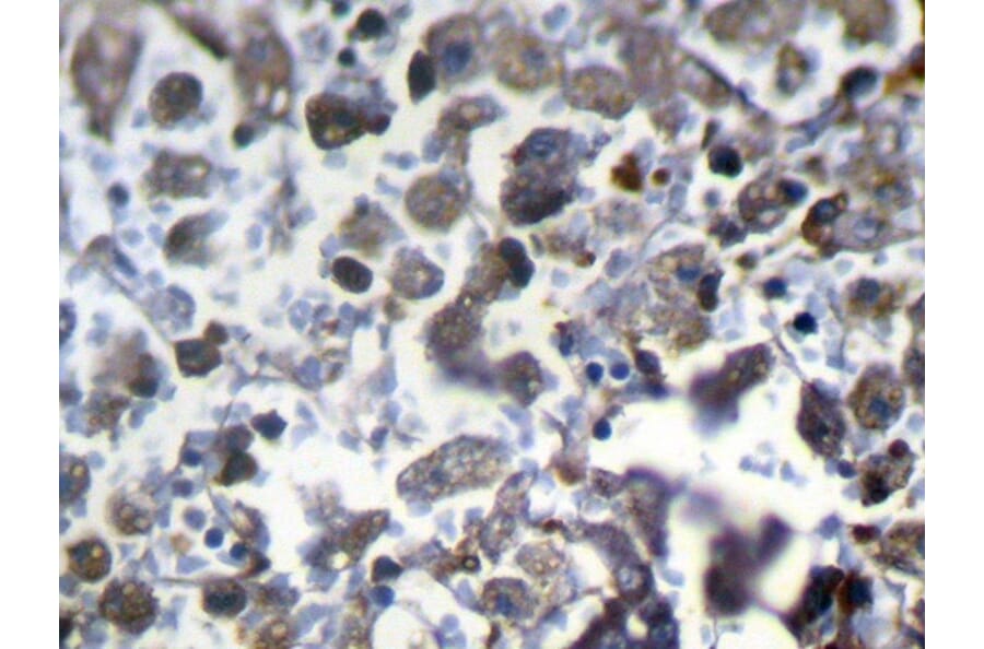 Immunohistochemistry - MED22 Antibody from Signalway Antibody (40342) - Antibodies.com