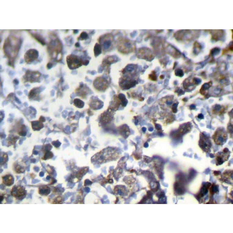 Immunohistochemistry - MED22 Antibody from Signalway Antibody (40342) - Antibodies.com