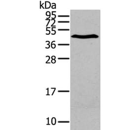 LPAR1 Antibody from Signalway Antibody (40360) - Antibodies.com