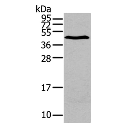 LPAR1 Antibody from Signalway Antibody (40360) - Antibodies.com