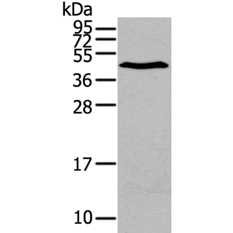 LPAR1 Antibody from Signalway Antibody (40360) - Antibodies.com