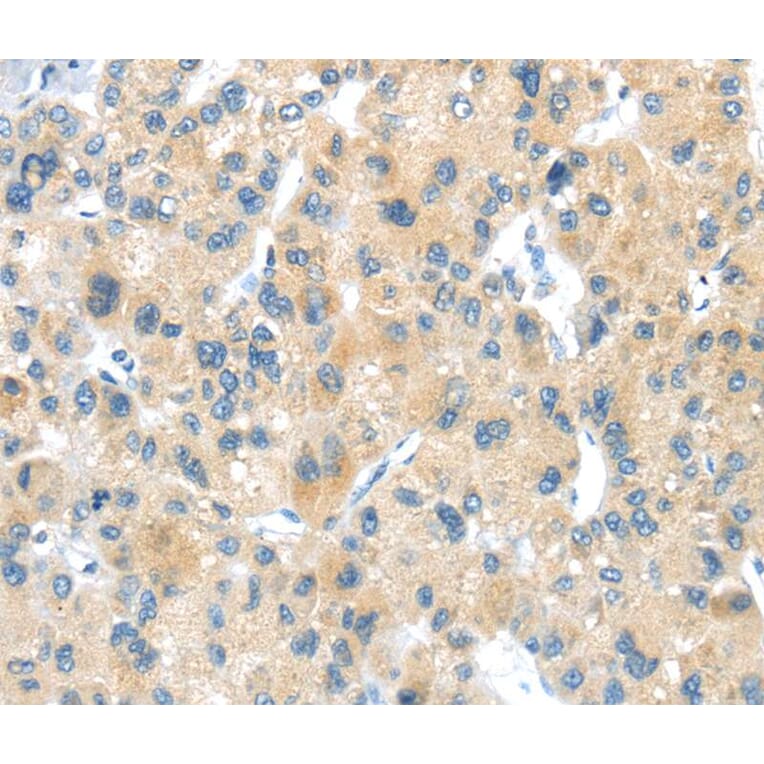 Immunohistochemistry - LPAR1 Antibody from Signalway Antibody (40360) - Antibodies.com