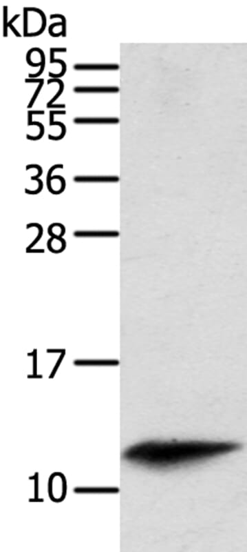 Gel: 12% SDS-PAGE Lysate: 40ug Mouse spleen tissue. Primary antibody: 1/200 dilution Secondary antibody dilution: 1/8000Exposure time: 40 seconds