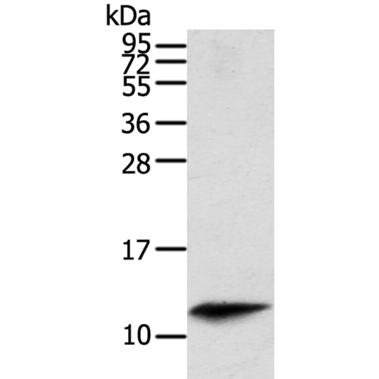 PBOV1 Antibody from Signalway Antibody (40366) - Antibodies.com