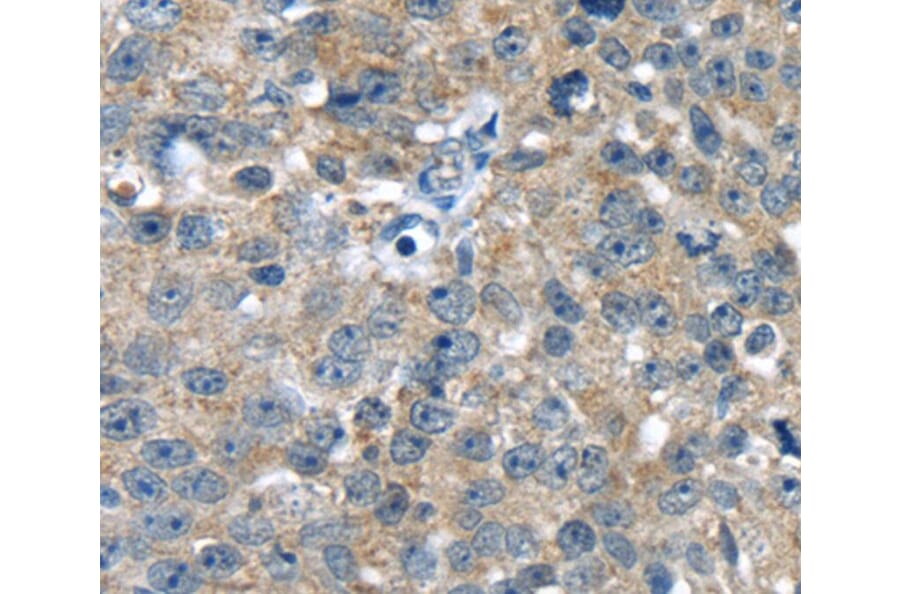 Immunohistochemistry - PBOV1 Antibody from Signalway Antibody (40366) - Antibodies.com