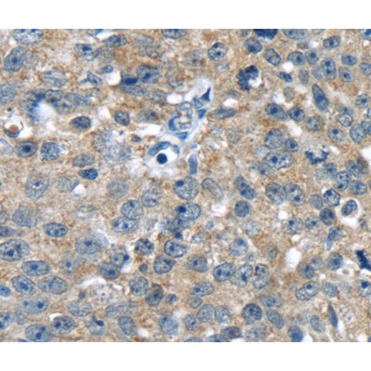 Immunohistochemistry - PBOV1 Antibody from Signalway Antibody (40366) - Antibodies.com