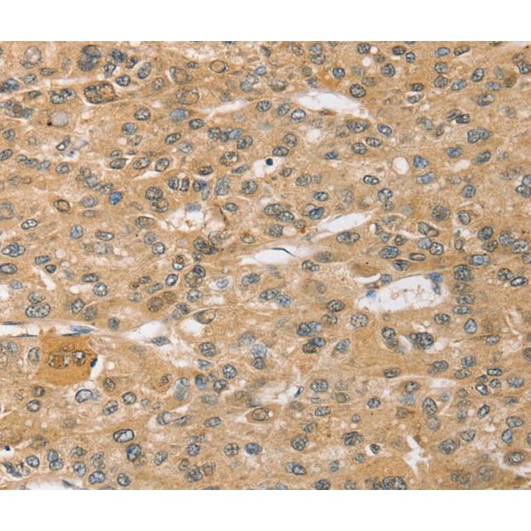 Immunohistochemistry - SPON1 Antibody from Signalway Antibody (40372) - Antibodies.com