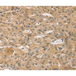 Immunohistochemistry - SPON1 Antibody from Signalway Antibody (40372) - Antibodies.com