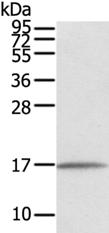 Gel: 12% SDS-PAGE Lysate: 40ug Human normal liver tissue. Primary antibody: 1/550 dilution Secondary antibody dilution: 1/8000Exposure time: 10 seconds