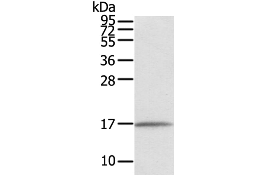 EVA1A Antibody from Signalway Antibody (40386) - Antibodies.com