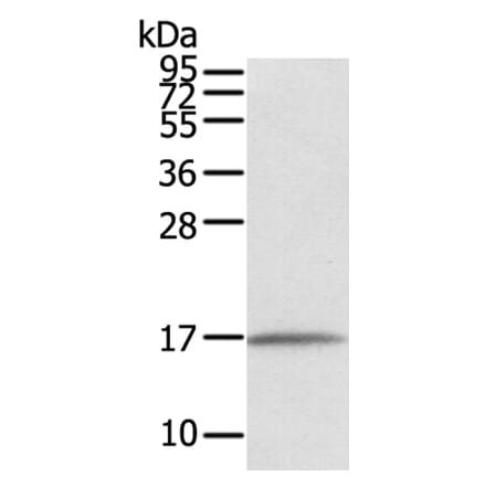 EVA1A Antibody from Signalway Antibody (40386) - Antibodies.com