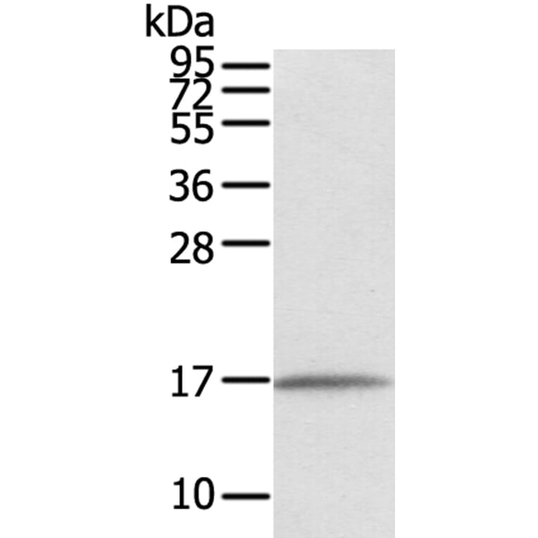 EVA1A Antibody from Signalway Antibody (40386) - Antibodies.com