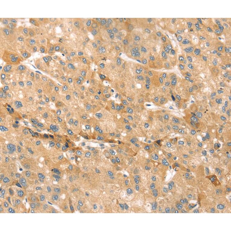 Immunohistochemistry - EVA1A Antibody from Signalway Antibody (40386) - Antibodies.com