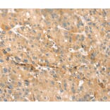 Immunohistochemistry - EVA1A Antibody from Signalway Antibody (40386) - Antibodies.com