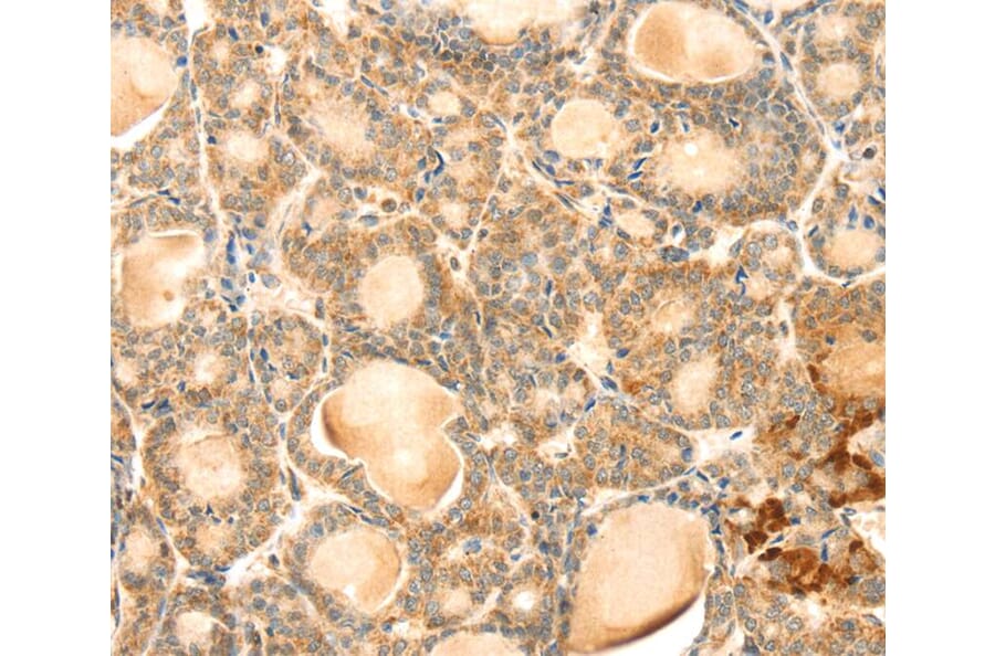 Immunohistochemistry - EVA1A Antibody from Signalway Antibody (40386) - Antibodies.com