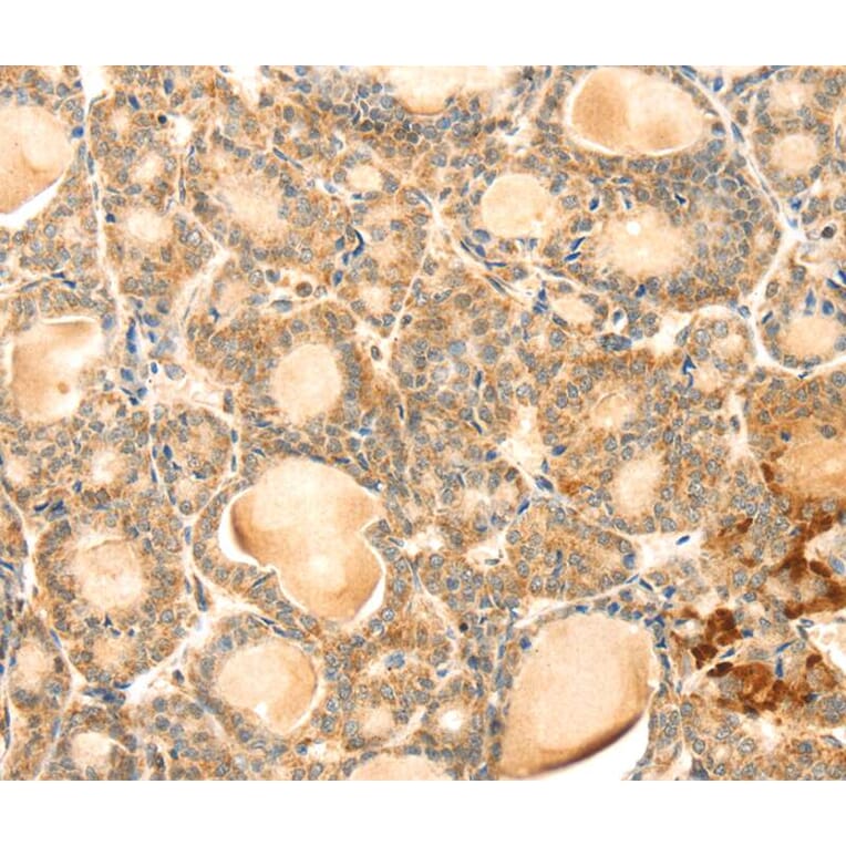 Immunohistochemistry - EVA1A Antibody from Signalway Antibody (40386) - Antibodies.com