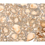 Immunohistochemistry - EVA1A Antibody from Signalway Antibody (40386) - Antibodies.com