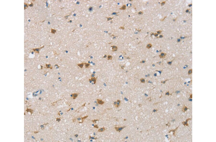 Immunohistochemistry - CSPG4 Antibody from Signalway Antibody (40391) - Antibodies.com