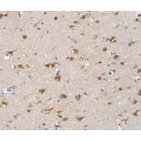 Immunohistochemistry - CSPG4 Antibody from Signalway Antibody (40391) - Antibodies.com