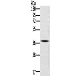 SPARC Antibody from Signalway Antibody (42713) - Antibodies.com