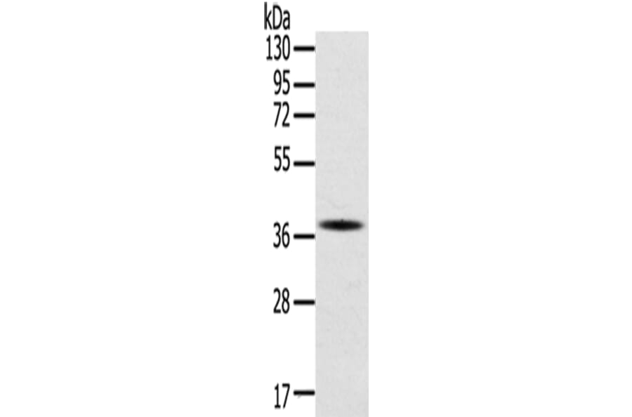 SPARC Antibody from Signalway Antibody (42713) - Antibodies.com
