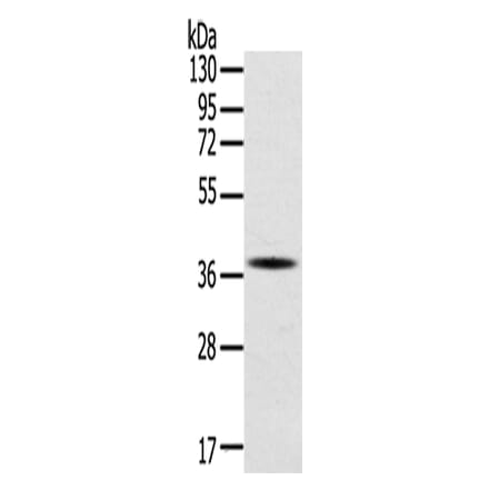 SPARC Antibody from Signalway Antibody (42713) - Antibodies.com