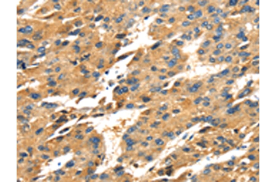 Immunohistochemistry - SPARC Antibody from Signalway Antibody (42713) - Antibodies.com