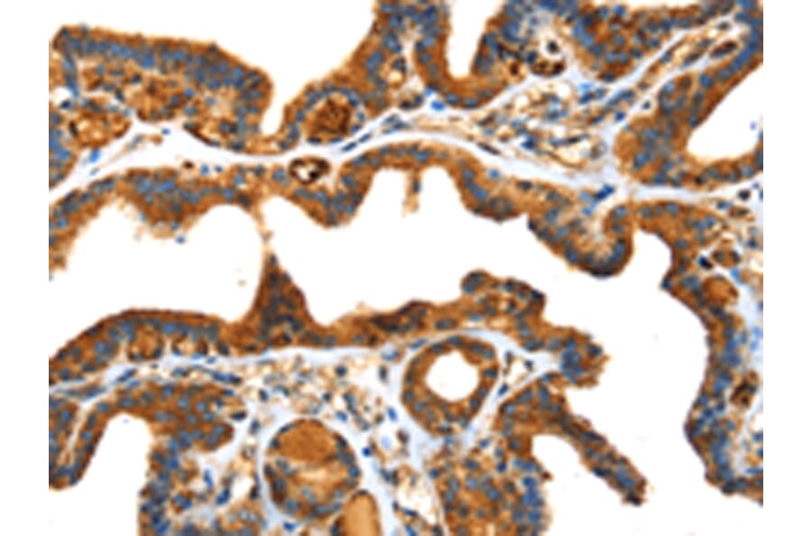 Immunohistochemistry - SPARC Antibody from Signalway Antibody (42713) - Antibodies.com