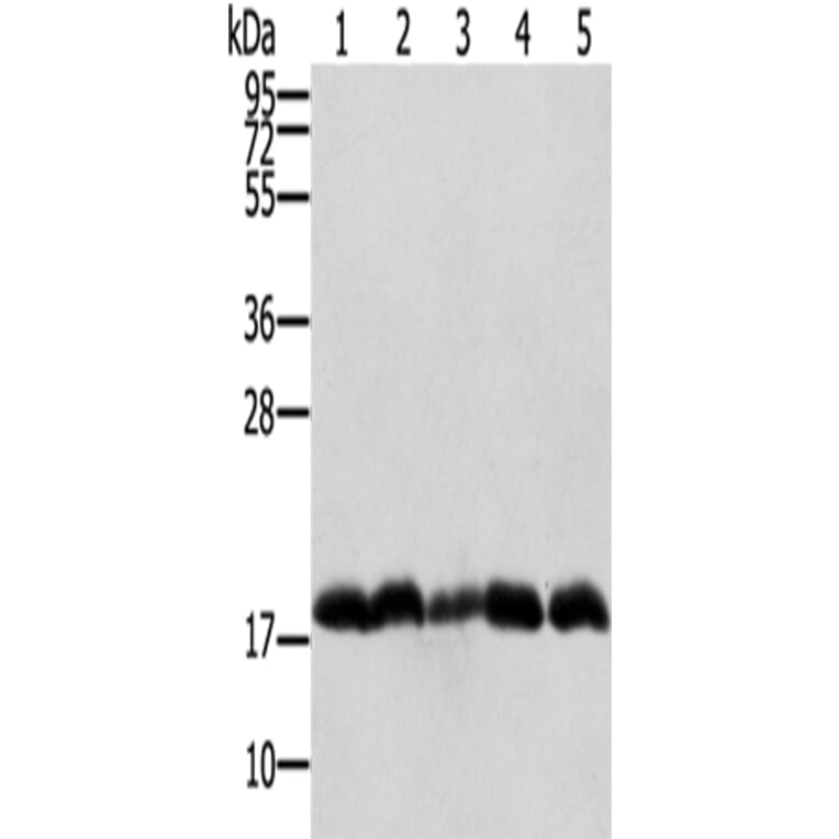 PTRH2 Antibody from Signalway Antibody (42725) - Antibodies.com