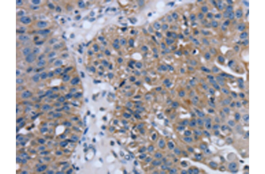 Immunohistochemistry - PTRH2 Antibody from Signalway Antibody (42725) - Antibodies.com