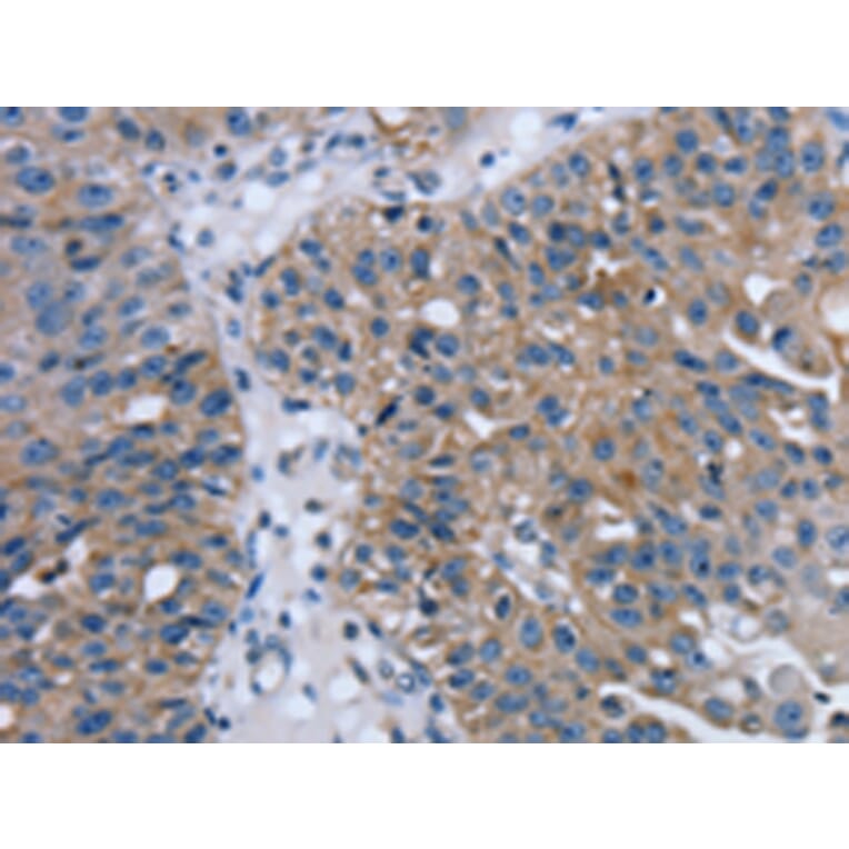 Immunohistochemistry - PTRH2 Antibody from Signalway Antibody (42725) - Antibodies.com
