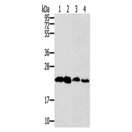 RAB9A Antibody from Signalway Antibody (42726) - Antibodies.com