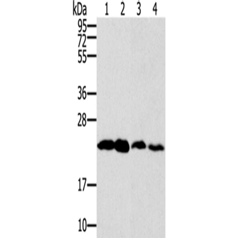 RAB9A Antibody from Signalway Antibody (42726) - Antibodies.com