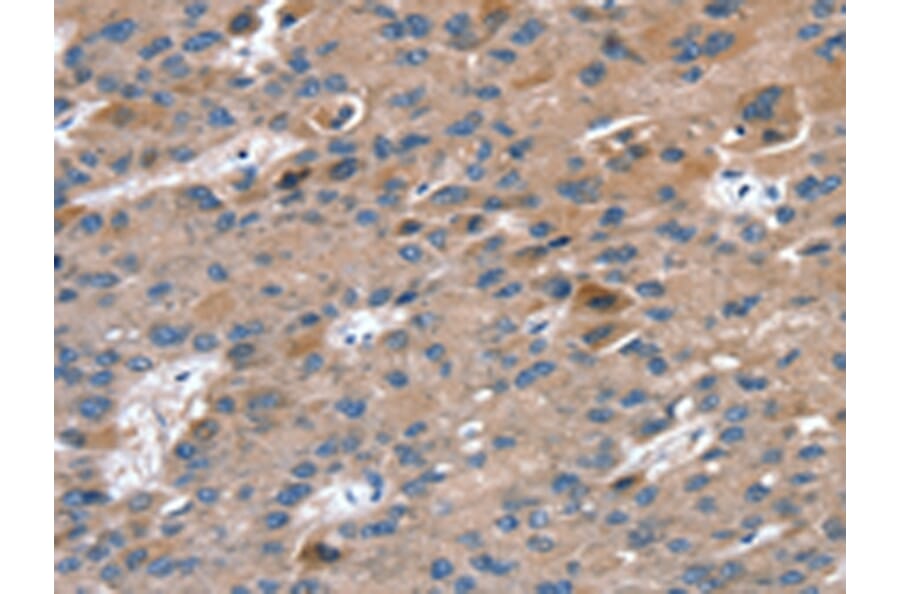 Immunohistochemistry - RAB9A Antibody from Signalway Antibody (42726) - Antibodies.com