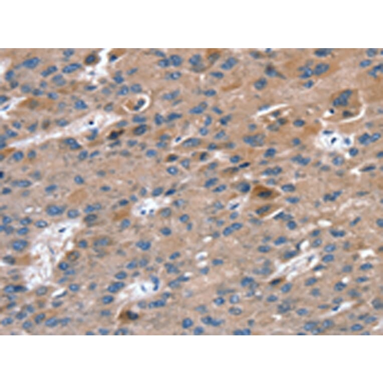 Immunohistochemistry - RAB9A Antibody from Signalway Antibody (42726) - Antibodies.com