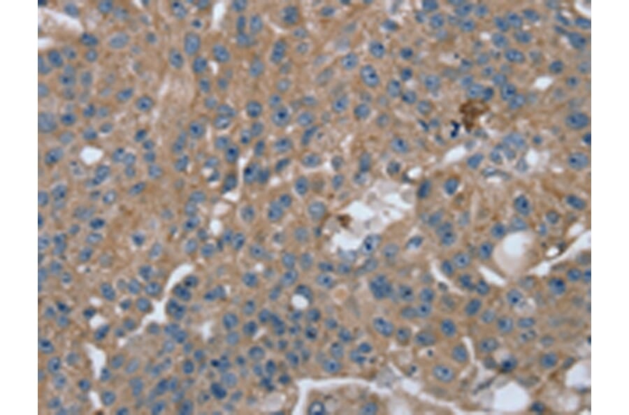 Immunohistochemistry - RAB9A Antibody from Signalway Antibody (42726) - Antibodies.com