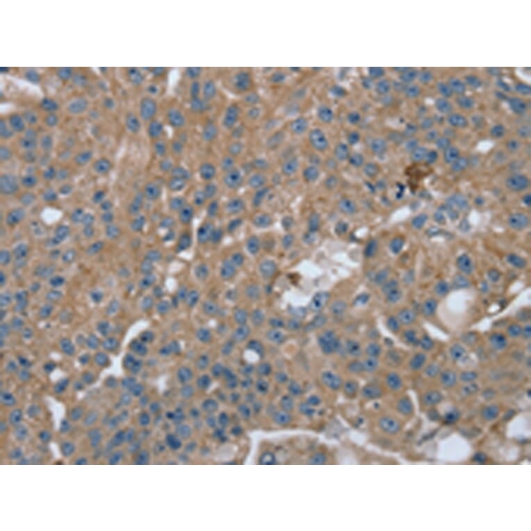 Immunohistochemistry - RAB9A Antibody from Signalway Antibody (42726) - Antibodies.com