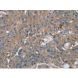 Immunohistochemistry - RAB9A Antibody from Signalway Antibody (42726) - Antibodies.com