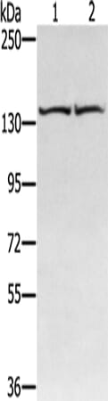 Gel: 6%SDS-PAGE Lysate: 40 &#956;g Lane 1-2: Hela cells, hepg2 cells Primary antibody: 1/400 dilution Secondary antibody: Goat anti rabbit IgG at 1/8000 dilution Exposure time: 20 seconds