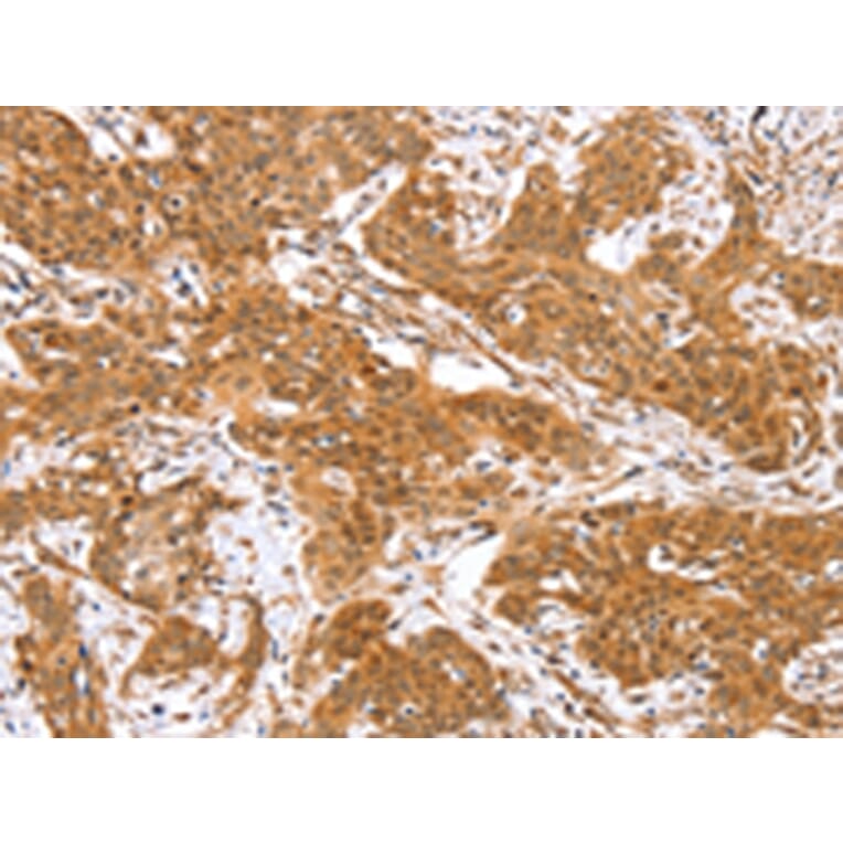 Immunohistochemistry - RGS22 Antibody from Signalway Antibody (42736) - Antibodies.com