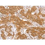 Immunohistochemistry - RGS22 Antibody from Signalway Antibody (42736) - Antibodies.com