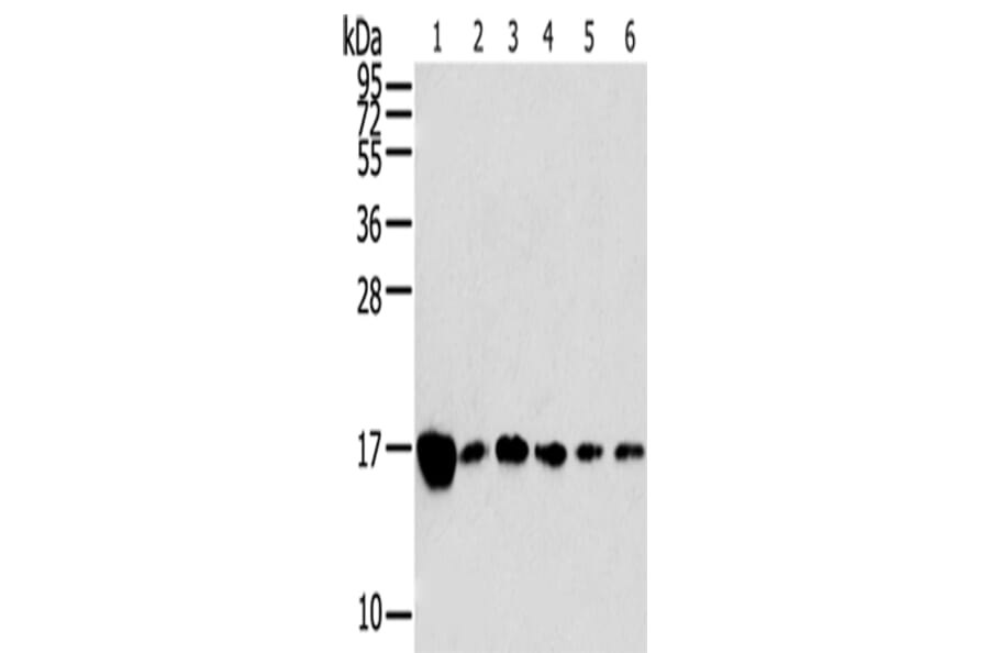 RPLP2 Antibody from Signalway Antibody (42743) - Antibodies.com