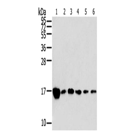 RPLP2 Antibody from Signalway Antibody (42743) - Antibodies.com