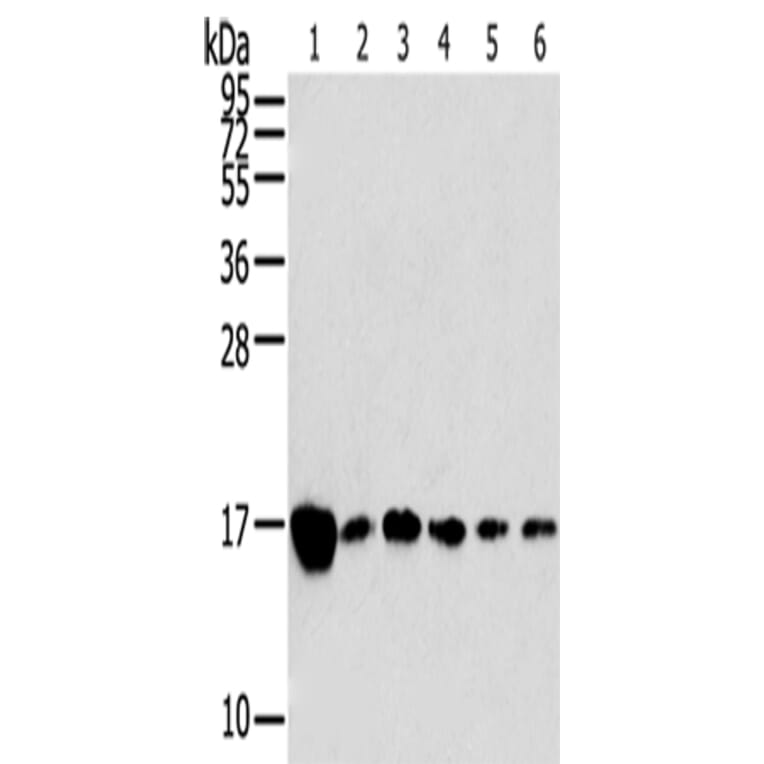 RPLP2 Antibody from Signalway Antibody (42743) - Antibodies.com