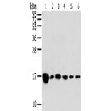 RPLP2 Antibody from Signalway Antibody (42743) - Antibodies.com