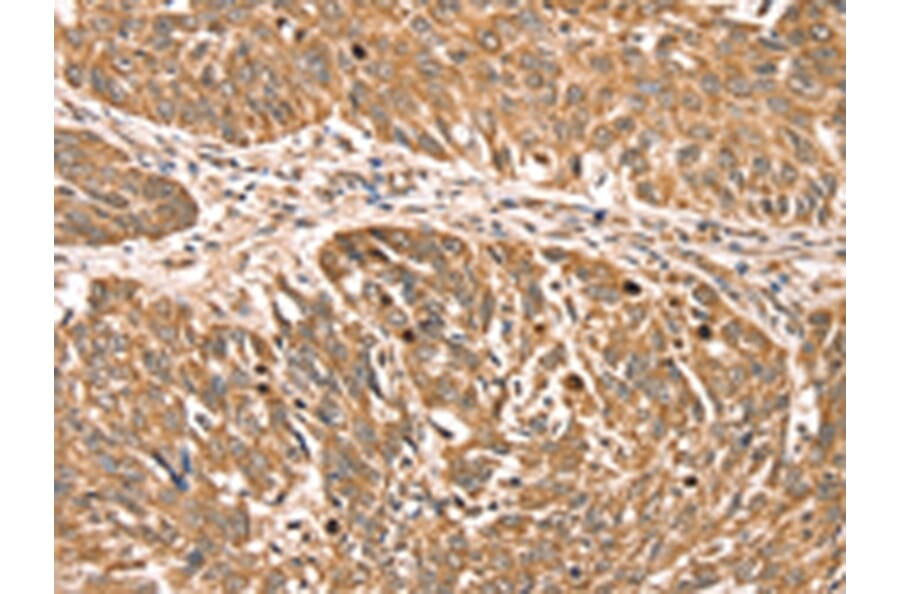 Immunohistochemistry - RPLP2 Antibody from Signalway Antibody (42743) - Antibodies.com