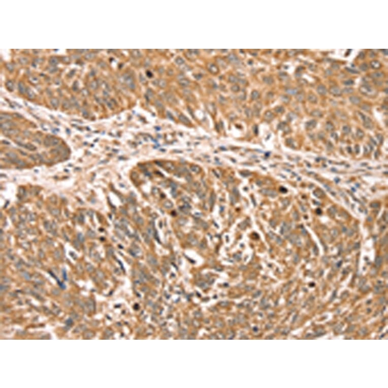 Immunohistochemistry - RPLP2 Antibody from Signalway Antibody (42743) - Antibodies.com