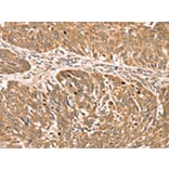 Immunohistochemistry - RPLP2 Antibody from Signalway Antibody (42743) - Antibodies.com