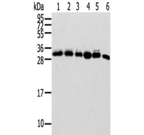 SENP8 Antibody from Signalway Antibody (42748) - Antibodies.com