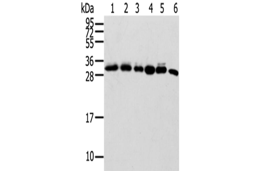 SENP8 Antibody from Signalway Antibody (42748) - Antibodies.com